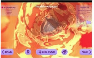 Virtual reality surgery lets Fresher doctors practice for operations